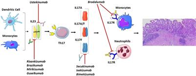 The IL23-IL17 Immune Axis in the Treatment of Ulcerative Colitis: Successes, Defeats, and Ongoing Challenges